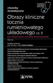 Obrazy kliniczne tocznia rumieniowatego ukadowego Cz 2, Majdan Maria