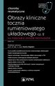 Obrazy kliniczne tocznia rumieniowatego ukadowego Cz 2, Majdan Maria